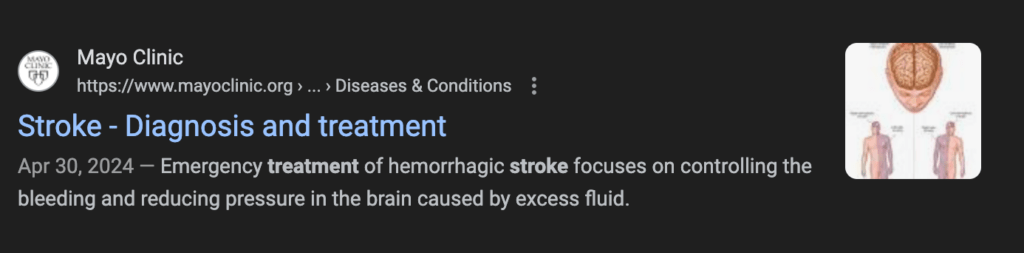 Stroke Treatment Google Search Result